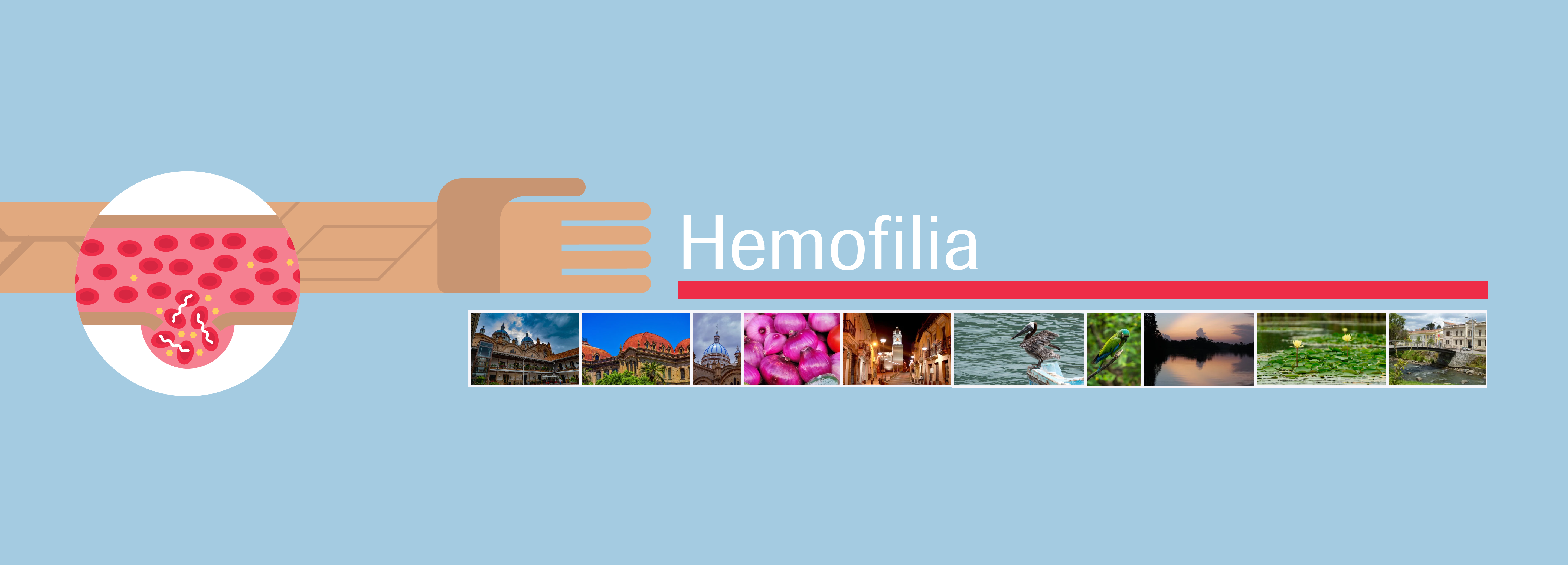 Signos Y Síntomas De La Hemofilia 5808